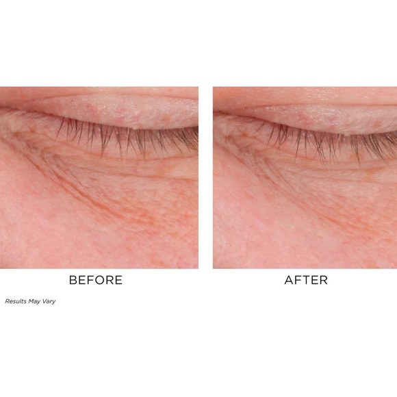 Perricone MD Cold Plasma Plus+ Eye - Picture 6 of 7